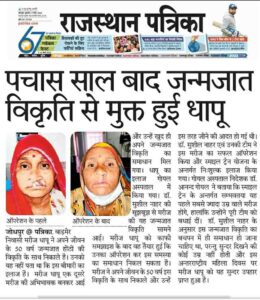 Dr. Sushil Nahar Best Plastic Surgeon Jodhpur Rajasthan - Cleft Lip Birth Deformity Success Story Newspaper Article