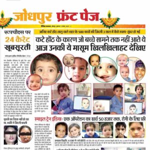 Dr. Sushil Nahar Best Plastic Surgeon Jodhpur Rajasthan - Cleft Lip and Cleft Palate Birth Deformity Success Story Newspaper Article