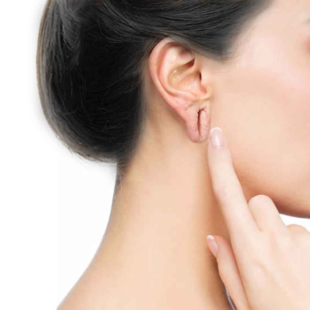 Ear Lobe Repair Surgery - Dr. Sushil Nahar - Plastic Surgeon - Rajasthan India