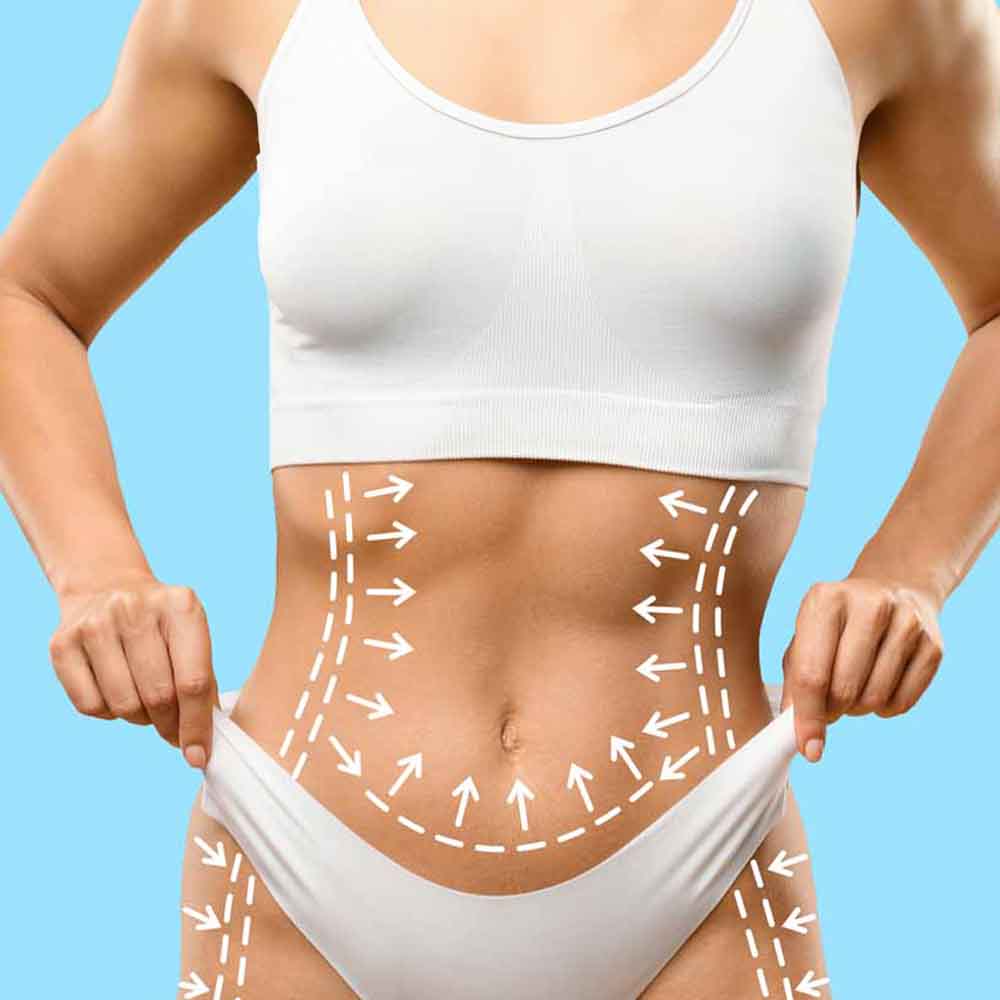 Liposculpturing Surgery - Dr. Sushil Nahar - Plastic Surgeon - Rajasthan India